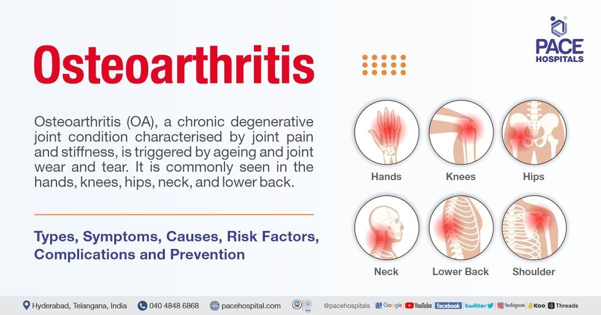 Osteoarthritis: Symptoms, Causes, Risk Factors, Complications